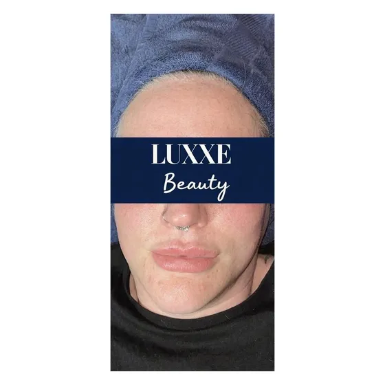 A fresh, glowing skin result after a facial at Luxxe Beauty